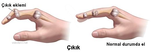 Qiriq və cıxıqlar